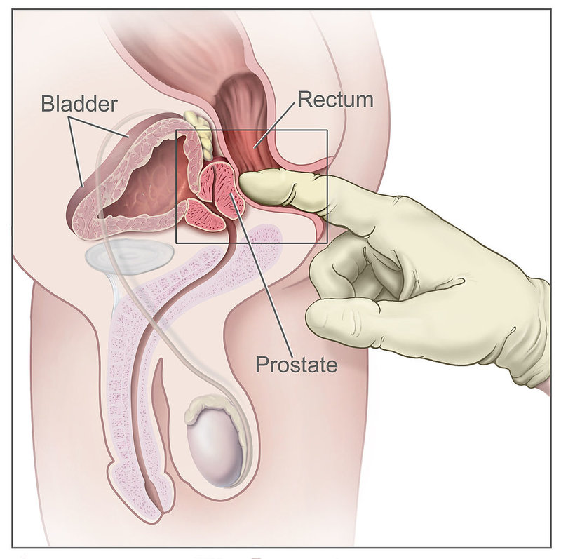 a prostatitis antibiotikumok nem segítenek